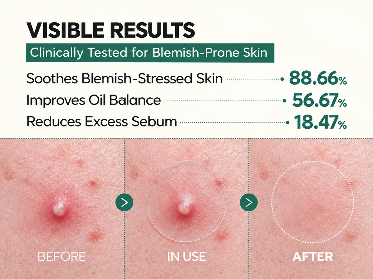 Visible results, clinically tested for blemish-prone skin: before, in use and after