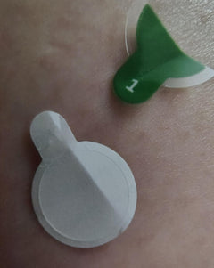 Customer photo: Zero-Fit patch on skin with the green film tab