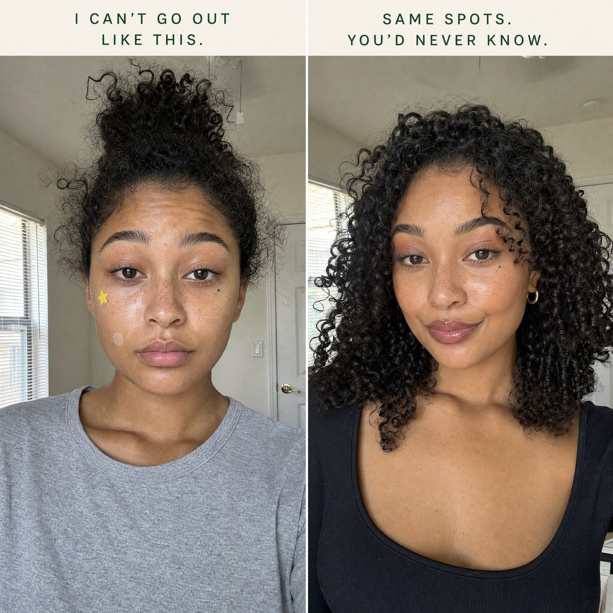 Zero-Fit S-ZINC blemish patch before and after: same spots, covered under makeup