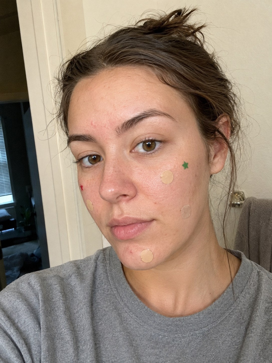 Beige and star-shaped pimple patches clearly visible on a face