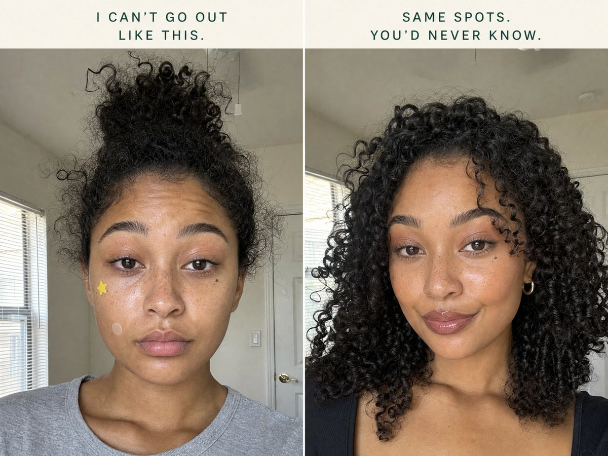 Two photographs of the same person, first with bare skin and then with makeup worn over the patches.