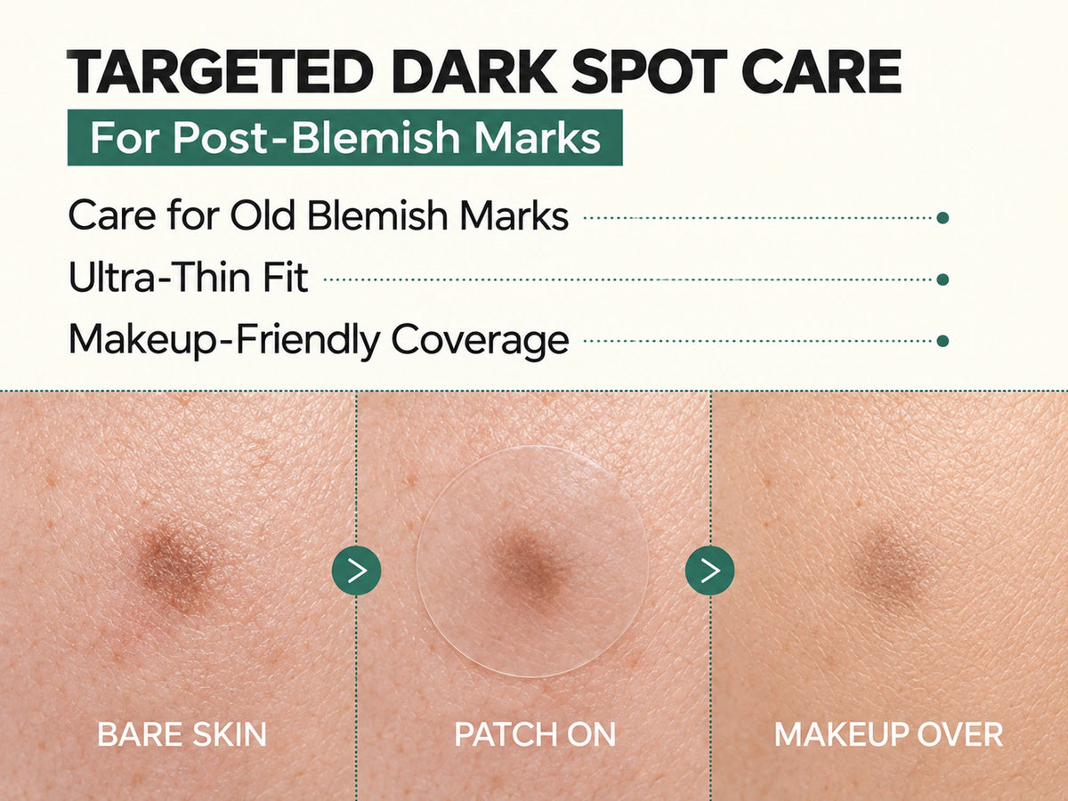 Three close-ups of the same mark: bare skin, patch on, and makeup over the patch.