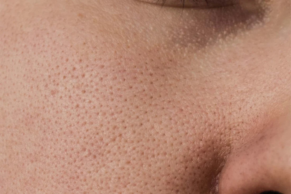 Visible pores around the nose and cheek